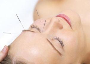 针灸妇女大腿两侧视频,针灸疗法助力女性缓解大腿两侧不适